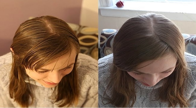 The ‘No Shampoo Experiment,’ Six Months Later